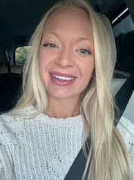 Porcelain veneers recovery experience