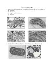 Check spelling or type a new query. Electron Micrograph
