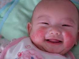Semasa bayi anda menyusu, susu akan terpercik dan tumpah lalu terkena muka bayi. 4 Petua Tradisional Hilangkan Mak Kuntum Postnatal Herbs Facebook