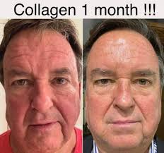 Collagen peptides factor 4, amazing products we must have everyday you will  feel the difference with your health alot of changes especially i can walk  for 1 hr. No heaviness in breathing,