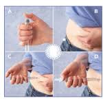 If you are using a cloudy insulin, gently roll the pen between your hands to mix the insulin. Insulin Pen How To Use An Insulin Pen Nu Hospitals Bangalore
