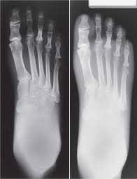 2 Film Screen Radiography Musculoskeletal Key