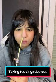 Retirer Une Sonde Naso Gastrique