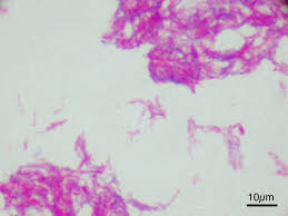 1 day ago · bovine tb can devastate cattle herds and hurt farm revenues. Mycobacterium Bovis Wikipedia