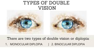 (pathology) an ophthalmologic condition where one perceives two images; Double Vision Types Causes Symptoms And Treatment