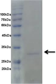 Genealogy for mohd anuar (deceased) family tree on geni, with over 200 million profiles of ancestors and living relatives. Recombinant Production And Characterization Of An Extracellular Subtilisin Like Serine Protease From Acinetobacter Baumannii Of Fermented Food Origin Springerlink