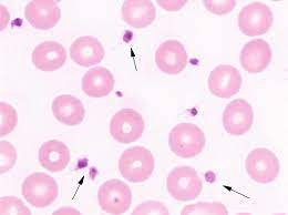High platelet count platelets, also known as thrombocytes, are blood cells responsible for blood clotting. Thrombozyten Springerlink
