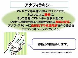 道模型 車・バイク プラモデル ミニ四駆 プラモデル 工具・塗料・材料 工具 塗料 材料 キャラクターグッズ コレクショントイ,食玩 ファッション メンズファッ. Wqiolubvg1stim