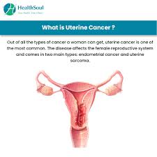 Before your doctor decides your stage, they'll use tests, such as a biopsy and ultrasound, to find what type of uterine cancer you have. Uterine Cancer Symptoms And Treatment Healthsoul