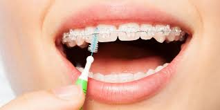 𝐈𝐧𝐭𝐞𝐫𝐝𝐞𝐧𝐭𝐚𝐥 𝐛𝐫𝐮𝐬𝐡 - 🦷 𝐅𝐨𝐫𝐞𝐬𝐭 & 𝐑𝐚𝐲 😊  𝐃𝐞𝐧𝐭𝐢𝐬𝐭𝐬, 𝐎𝐫𝐭𝐡𝐨𝐝𝐨𝐧𝐭𝐢𝐬𝐭𝐬, 𝐈𝐦𝐩𝐥𝐚𝐧𝐭  𝐒𝐮𝐫𝐠𝐞𝐨𝐧𝐬