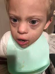 Benny's favorite food is pizza, despite limited vision