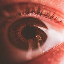 Image result for Eye Foreign Body