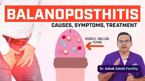 Image result for balanoposthitis