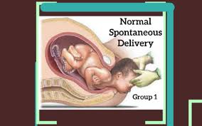 normal spontaneous delivery by sofia ballaran on prezi