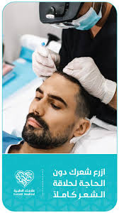 زراعة الشعر medical rings for men men