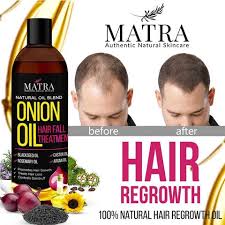 Black seed benefits for the most popular hair is to prevent hair loss. Onion Hair Growth Oil With Blackseed Oil Castor Oil Argan Oil Qtrove