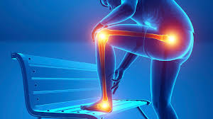 Image result for Leg Pain
