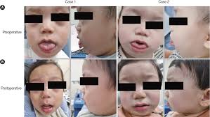 Clinical and Experimental Otorhinolaryngology