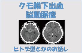 本站内容可能令人反感；不将本站内容派发，出售。 出租，交给或出借予年龄未满18岁人士出示，播放或播映。 this article contains material which may offernd and may not be distributed,circulated,sold,hired,given,lent,shown, played or projected to a. ã‚¯ãƒ¢è†œä¸‹å‡ºè¡€ ãƒ¬ãƒ³ãƒˆã‚²ãƒ³æŠ€å¸«ã‚«ãƒ¯ã‚·ãƒžã§ã™