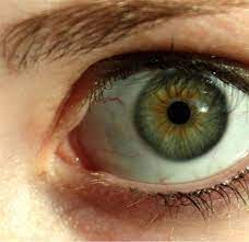 The ring, which can also appear gray or white, appears to surround the iris of your eye but is actually located within the cornea—the transparent outer layer of your eye. Why Do Some People Have Dark Rings Around The Iris Of Their Eye Bellatory
