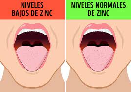 9 Cosas Que Pueden Provocarte Un Mal Sabor En La Boca Genial