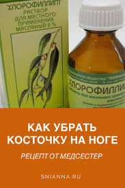 как лечить косточку на ноге в домашних условиях отзывы Kak Ubrat Kostochku Na Noge Recept Ot Medsester Zhenskoe Zdorove Health And Wellness Center Health Remedies Natural Health Remedies