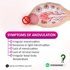 Image result for Anovulation