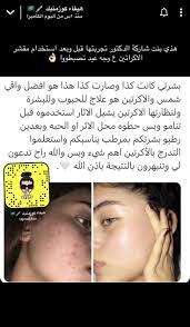 Ada Kaiser (baenkaer)