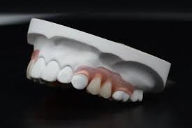 Like other normal dentures, denture hygiene is important in order to prolong their. China Strong And Durable Valplast Flexible Dentures Dental Partials Denture For Loss China Valplast Dental
