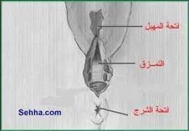 تمزق المهبل والجراحة بعد الولادة بالصور وعندي اسشارة الصفحة 10 عالم حواء