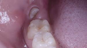 We did not find results for: Cientificos Japoneses Descubren Como Hacer Para Que Los Dientes Crezcan Nuevamente