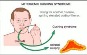 Diseases Of The Adrenal Glands Flashcards Quizlet