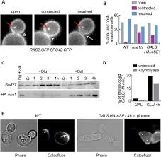 Maybe you would like to learn more about one of these? The Nocut Pathway Links Completion Of Cytokinesis To Spindle Midzone Function To Prevent Chromosome Breakage Cell