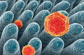 For clarity, the disease will be termed hepatitis a while the viral cause will be termed hav. Hepatitis A What You Need To Know Positively Aware