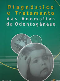 Livro Diagnóstico e Tratamento das Anomalias da Odontogênese de Vera Campos;  Roberval A. Cruz pela Santos (2004)