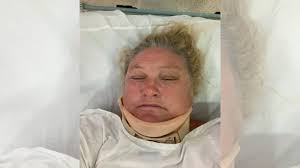 Oxford Falls: Horse rider left with spinal injuries calls for better safety 