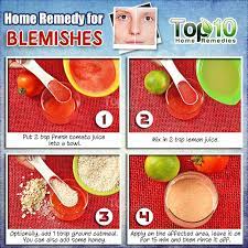 Since tomatoes are rich in vitamin c and antioxidants, they are best suited to heal the skin. 10 Home Remedies For Facial Blemishes And Self Care Tips Natural Acne Remedies Acne Remedies Home Remedies For Acne