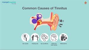 Image result for Tinnitus