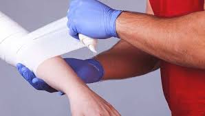 Chemical burn of the skin. Burn Scars Treatment And More
