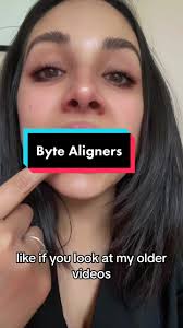 #ByteAligners #bytealignersreview #bytealignersresults #fyp #foryoupage  #foryou #viral #teeth #invisalign #smiledirectclub #byte