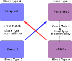 Organ Transplantation Wikipedia