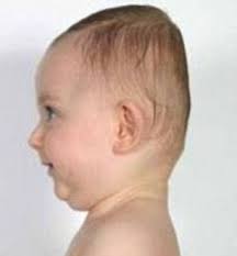 Babies and flat heads on sale