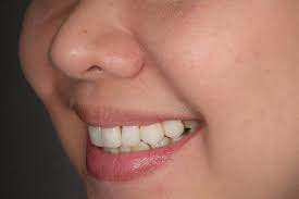 Olga Vionita Lay, drg. (@drg.olga) • Instagram photos and videos