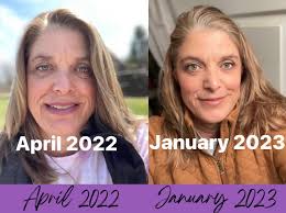 Senecell skincare transformation results