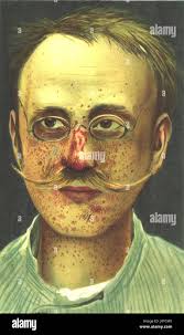 Neurodevelopmental research hi-res stock photography and images