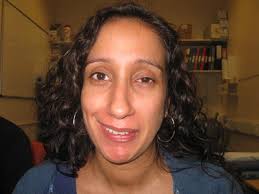 Foodborne botulism, wound botulism, and infant botulism. Botulinum Toxin Facial Palsy Uk