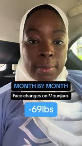 I can finally see the difference in my face after almost 7 months