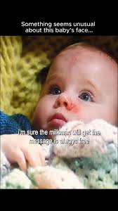 Something seems unusual about this baby’s face...