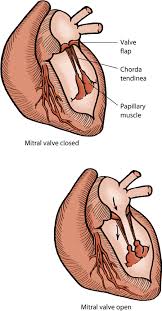 When symptoms arise that involve a heart murmur, treatment would be gauged based on the symptoms that are occurring. Congenital And Inherited Disorders Of The Cardiovascular System In Dogs Dog Owners Veterinary Manual
