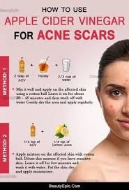 Pin On Beauty Secrets